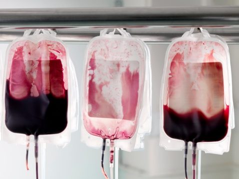 Need for Blood Donation Reaching Critical in Area - Vimarsana News